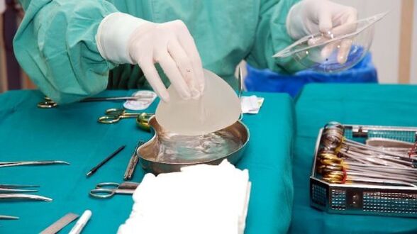 mellnagyobbító implantátum